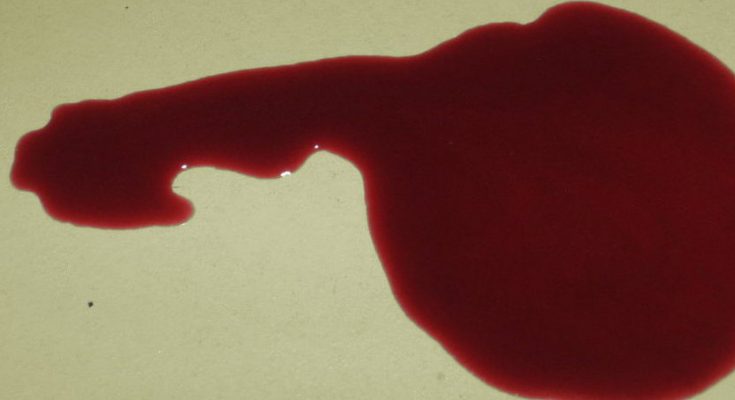 nam-mo-thay-minh-chay-mau-2